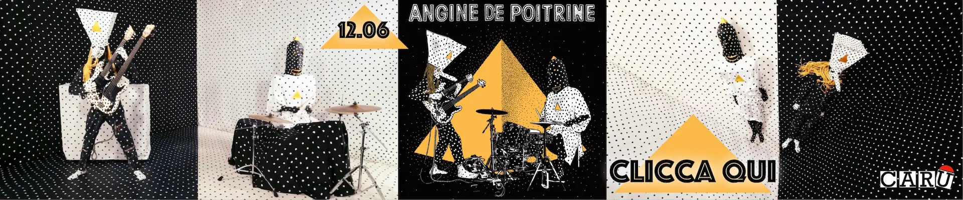 Angine de Poitrine